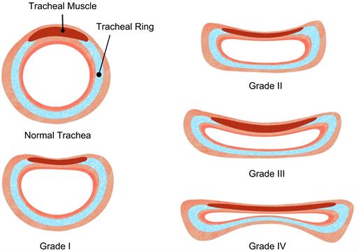 A diagram of tracheal collapse stages in dogs.