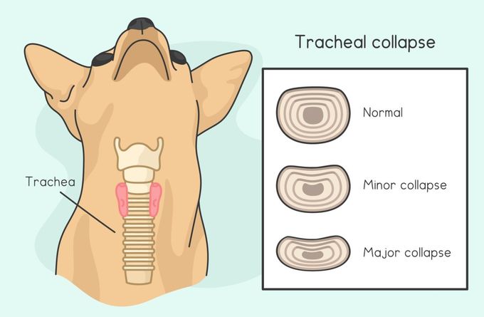 A diagram of tracheal collapse in dogs.